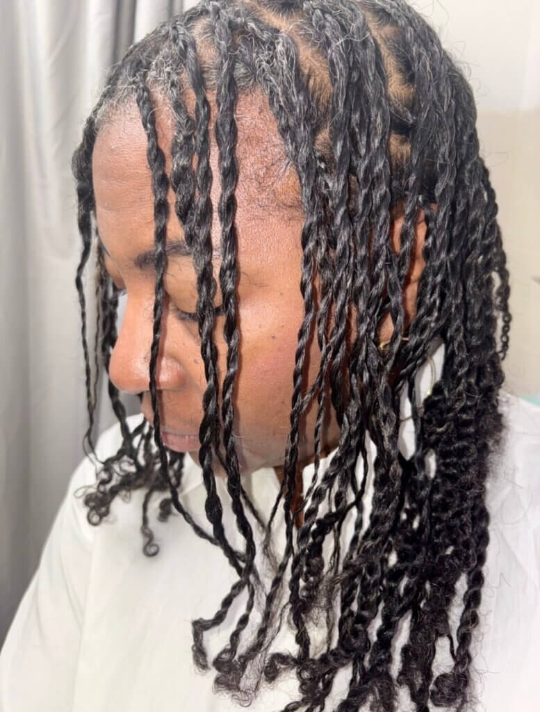 scalpy minni twists